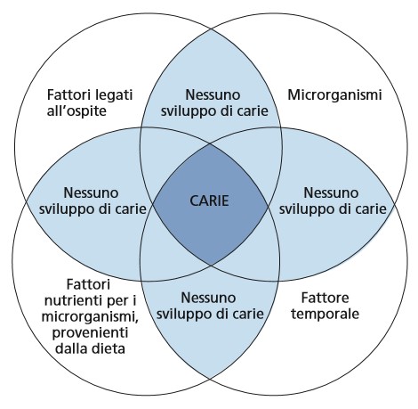 perchè si cariano i denti?